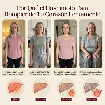 REGULADOR DE TIROIDES